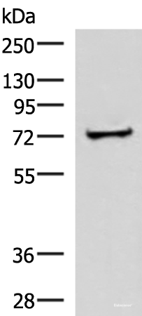 Western blot analysis of Human liver tissue lysate using ZNF263 Polyclonal Antibody at dilution of 1:500