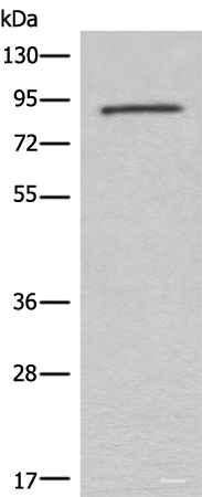 Western blot analysis of Mouse lung tissue lysate using C7 Polyclonal Antibody at dilution of 1:800