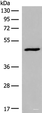 Western blot analysis of HL-60 cell lysate using DCP2 Polyclonal Antibody at dilution of 1:500