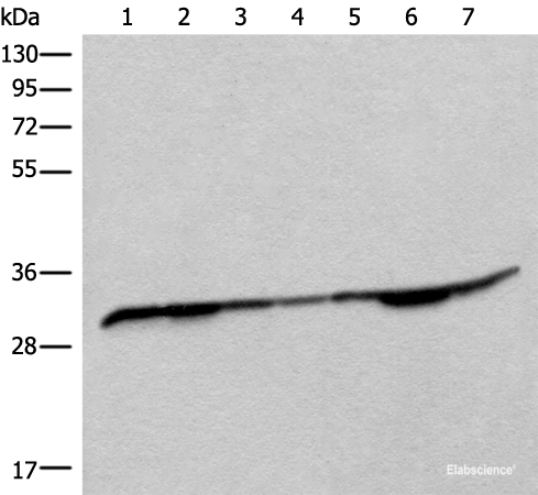 Western blot analysis of Rat heart tissue Mouse heart tissue Rat brain tissue Mouse brain tissue HEPG2 cell Jurkat and Lovo cell lysates using RSU1 Polyclonal Antibody at dilution of 1:400