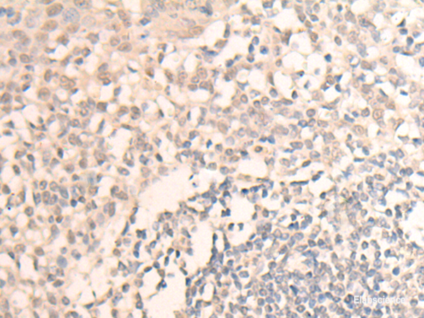 Immunohistochemistry of paraffin-embedded Human tonsil tissue using MLLT6 Polyclonal Antibody at dilution of 1:40(×200)