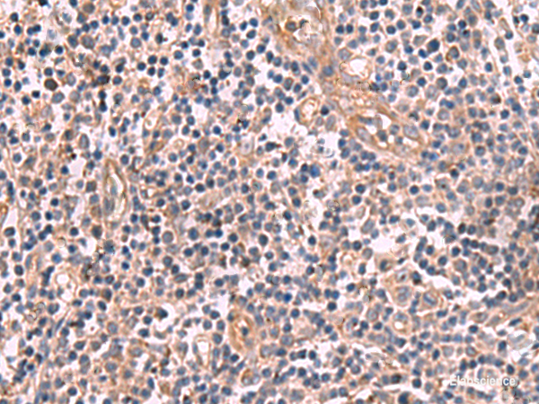 Immunohistochemistry of paraffin-embedded Human tonsil tissue using MGP Polyclonal Antibody at dilution of 1:75(×200)