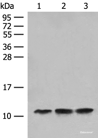 Western blot analysis of Human fetal liver tissue Hela cell HEPG2 cell lysates using ATP5L Polyclonal Antibody at dilution of 1:500