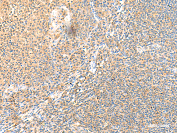 Immunohistochemistry of paraffin-embedded Human tonsil tissue using SSC4D Polyclonal Antibody at dilution of 1:70(×200)