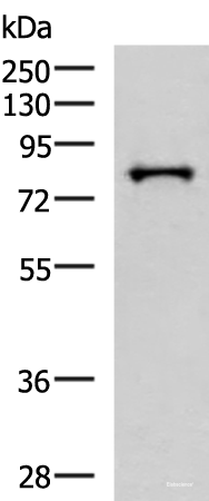 Western blot analysis of HepG2 cell lysate using PRPF3 Polyclonal Antibody at dilution of 1:2000