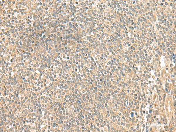 Immunohistochemistry of paraffin-embedded Human tonsil tissue using LMO3 Polyclonal Antibody at dilution of 1:50(×200)