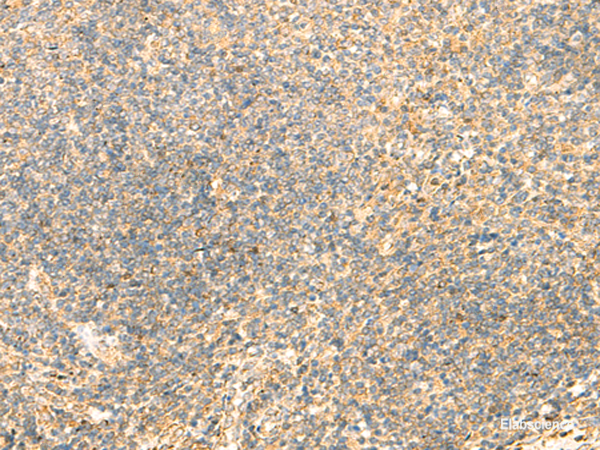 Immunohistochemistry of paraffin-embedded Human tonsil tissue using DHFR Polyclonal Antibody at dilution of 1:50(×200)