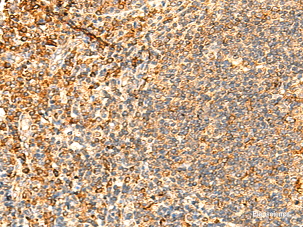 Immunohistochemistry of paraffin-embedded Human tonsil tissue using PPM1B Polyclonal Antibody at dilution of 1:50(×200)