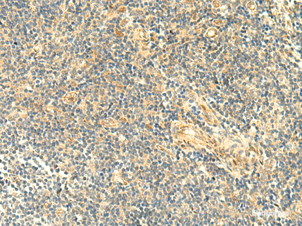 Immunohistochemistry of paraffin-embedded Human tonsil tissue using ASB6 Polyclonal Antibody at dilution of 1:50(×200)