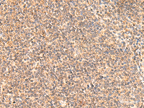 Immunohistochemistry of paraffin-embedded Human tonsil tissue using MOB1A Polyclonal Antibody at dilution of 1:50(×200)