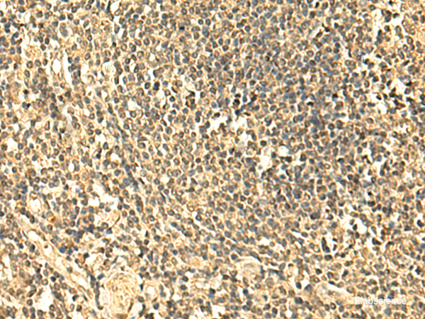 Immunohistochemistry of paraffin-embedded Human tonsil tissue using UNKL Polyclonal Antibody at dilution of 1:50(×200)