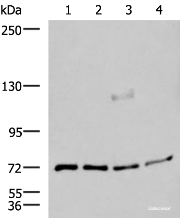 Western blot analysis of A549 A172 TM4 and PC3 cell lysates using ASTE1 Polyclonal Antibody at dilution of 1:600