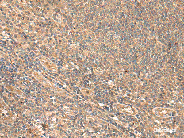 Immunohistochemistry of paraffin-embedded Human tonsil tissue using MEST Polyclonal Antibody at dilution of 1:65(×200)