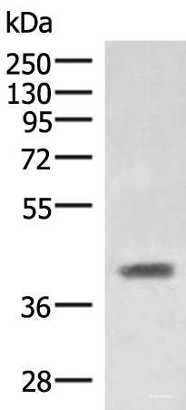 Western blot analysis of Mouse liver tissue lysate using SAMSN1 Polyclonal Antibody at dilution of 1:1000