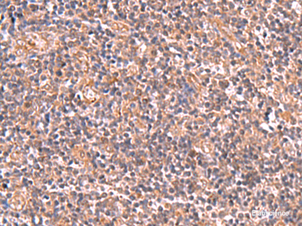Immunohistochemistry of paraffin-embedded Human tonsil tissue using UBAC1 Polyclonal Antibody at dilution of 1:50(×200)