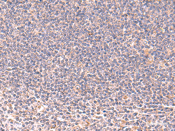 Immunohistochemistry of paraffin-embedded Human tonsil tissue using MANSC1 Polyclonal Antibody at dilution of 1:105(×200)
