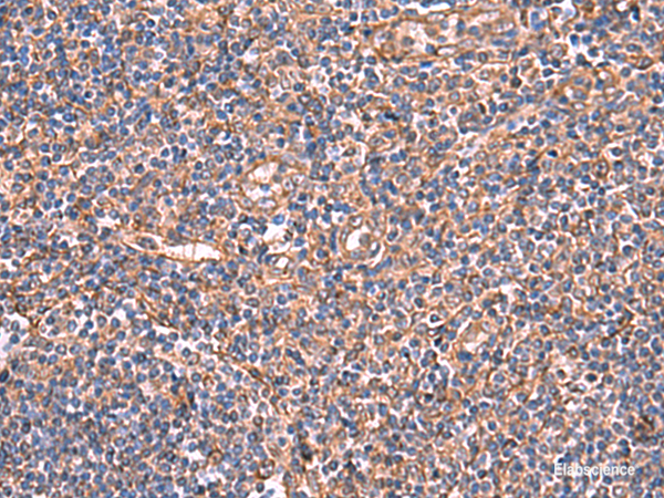 Immunohistochemistry of paraffin-embedded Human tonsil tissue using TTC38 Polyclonal Antibody at dilution of 1:50(×200)