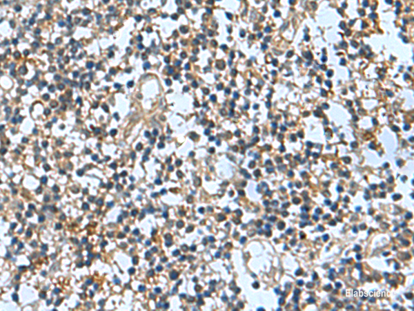 Immunohistochemistry of paraffin-embedded Human tonsil tissue using TRO Polyclonal Antibody at dilution of 1:65(×200)