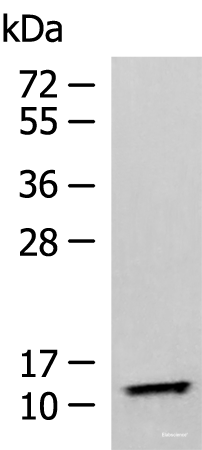 Western blot analysis of Human fetal liver tissue lysate using TMEM141 Polyclonal Antibody at dilution of 1:900
