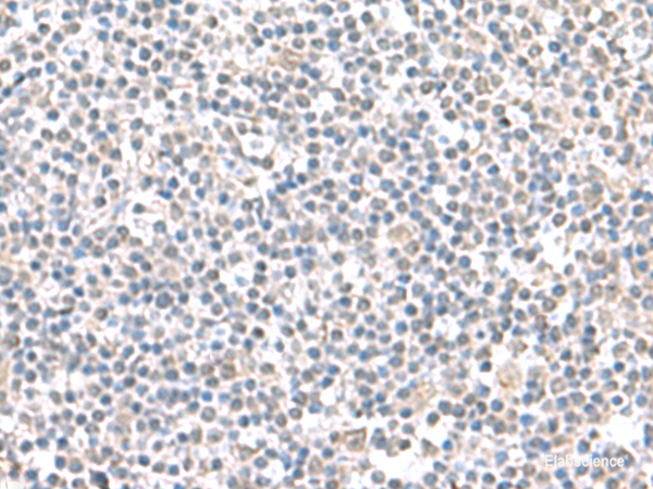 Immunohistochemistry of paraffin-embedded Human tonsil tissue using IFI27 Polyclonal Antibody at dilution of 1:100(×200)