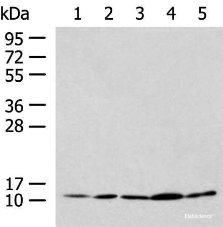 Western blot analysis of HL-60 Hela Jurkat LNCAP HepG2 cell lysates using PAM16 Polyclonal Antibody at dilution of 1:900