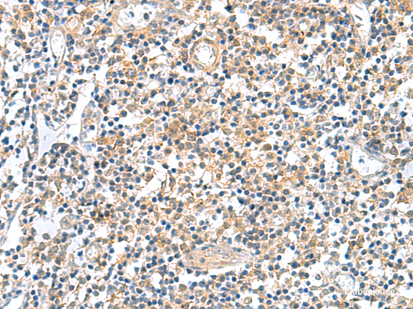 Immunohistochemistry of paraffin-embedded Human tonsil tissue using GEMIN7 Polyclonal Antibody at dilution of 1:50(×200)