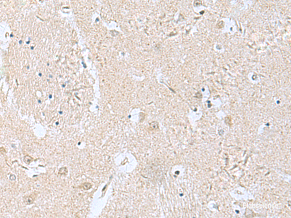 Immunohistochemistry of paraffin-embedded Human brain tissue using TPD52L3 Polyclonal Antibody at dilution of 1:160(×200)