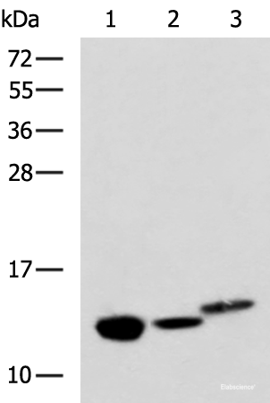 Western blot analysis of Rat kidney tissue Mouse liver tissue and Human fetal liver tissue lysates using RIDA Polyclonal Antibody at dilution of 1:600
