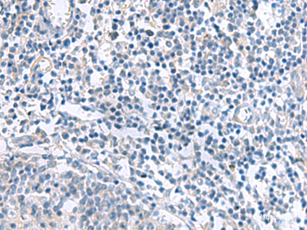 Immunohistochemistry of paraffin-embedded Human tonsil tissue using MYL1 Polyclonal Antibody at dilution of 1:50(×200)