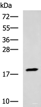Western blot analysis of Human muscle tissue lysate using TNNC2 Polyclonal Antibody at dilution of 1:400