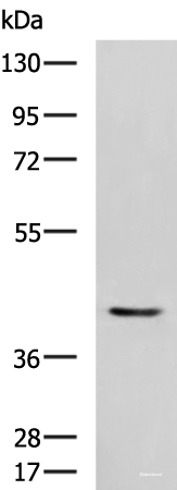 Western blot analysis of Mouse heart tissue lysate using STK32A Polyclonal Antibody at dilution of 1:1000