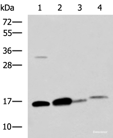 Western blot analysis of Human sigmoid tissue Mouse large intestine tissue Mouse small intestines tissue Mouse Pancreas tissue lysates using ZG16 Polyclonal Antibody at dilution of 1:800