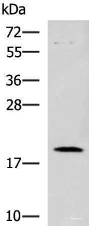 Western blot analysis of Human heart tissue lysate using DNPH1 Polyclonal Antibody at dilution of 1:800