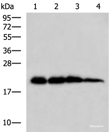 Western blot analysis of Rat brain tissue Hela HepG2 and A172 cell lysates using HPCAL1 Polyclonal Antibody at dilution of 1:1000