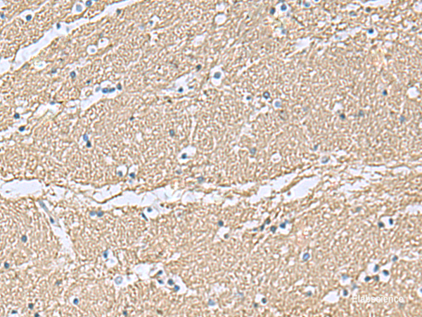 Immunohistochemistry of paraffin-embedded Human brain tissue using TAGLN3 Polyclonal Antibody at dilution of 1:70(×200)