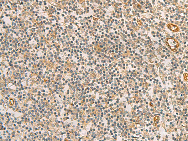 Immunohistochemistry of paraffin-embedded Human tonsil tissue using RAB13 Polyclonal Antibody at dilution of 1:50(×200)