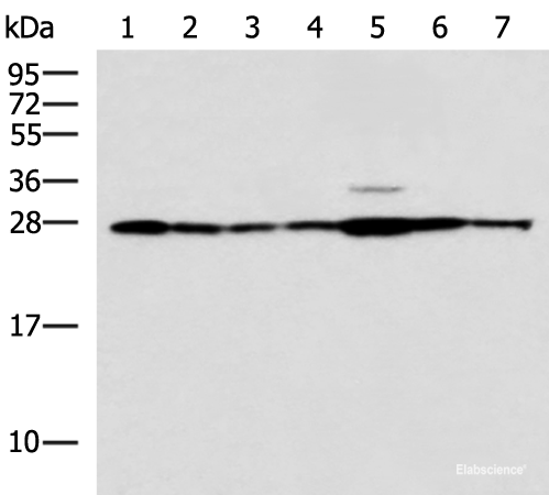 Western blot analysis of Rat liver tissue Mouse kidney tissue Mouse lung tissue HUVEC Jurkat Hela HepG2 cell lysates using RPL10A Polyclonal Antibody at dilution of 1:700