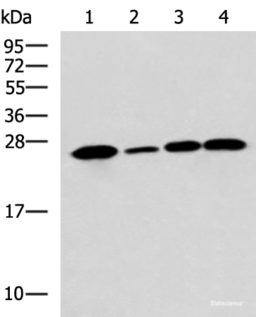 Western blot analysis of Human cerebrum tissue A172 cell Mouse brain tissue Rat brain tissue lysates using UCHL1 Polyclonal Antibody at dilution of 1:900
