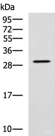 Western blot analysis of SP20 cell lysate using LRAT Polyclonal Antibody at dilution of 1:800