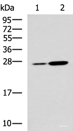 Western blot analysis of Mouse kidney tissue and Mouse liver tissue lysates using NQO2 Polyclonal Antibody at dilution of 1:1000