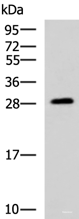 Western blot analysis of Human fetal brain tissue lysate using PAFAH1B3 Polyclonal Antibody at dilution of 1:1000