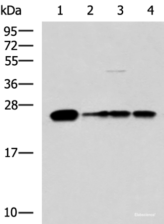 Western blot analysis of 293T LO2 and HepG2 cell lysates using MMAB Polyclonal Antibody at dilution of 1:1400