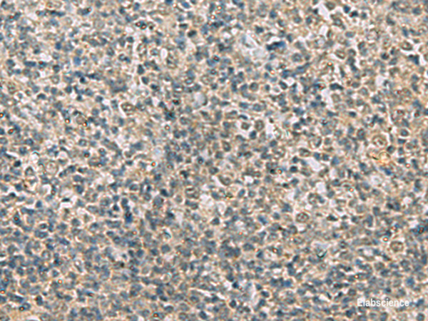 Immunohistochemistry of paraffin-embedded Human tonsil tissue using RAB3IP Polyclonal Antibody at dilution of 1:60(×200)