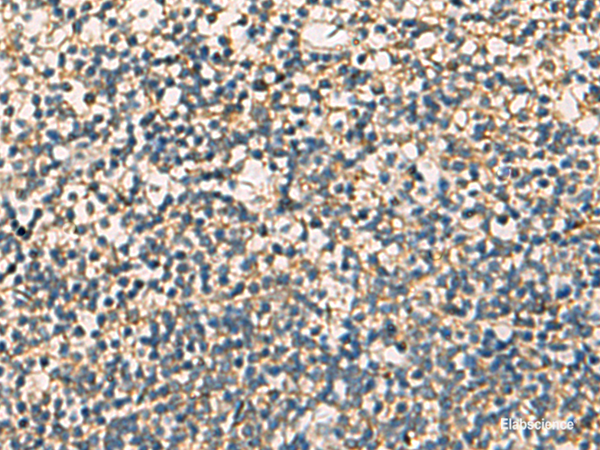 Immunohistochemistry of paraffin-embedded Human tonsil tissue using STX6 Polyclonal Antibody at dilution of 1:60(×200)