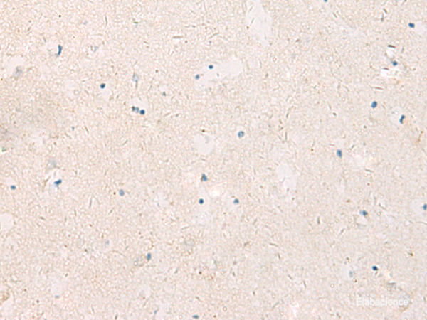 Immunohistochemistry of paraffin-embedded Human brain tissue using KCNIP3 Polyclonal Antibody at dilution of 1:90(×200)