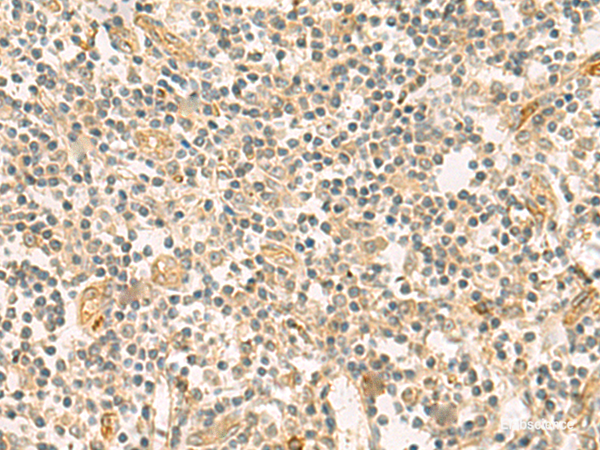 Immunohistochemistry of paraffin-embedded Human tonsil tissue using HHIPL2 Polyclonal Antibody at dilution of 1:55(×200)