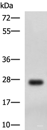 Western blot analysis of MCF7 cell lysate using DHRS2 Polyclonal Antibody at dilution of 1:750