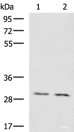 Western blot analysis of Mouse brain tissue Mouse kidney tissue lysates using KRCC1 Polyclonal Antibody at dilution of 1:1350