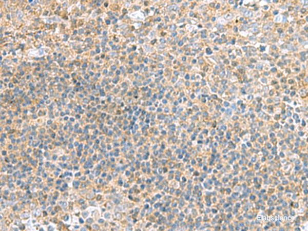 Immunohistochemistry of paraffin-embedded Human tonsil tissue using TSTA3 Polyclonal Antibody at dilution of 1:45(×200)