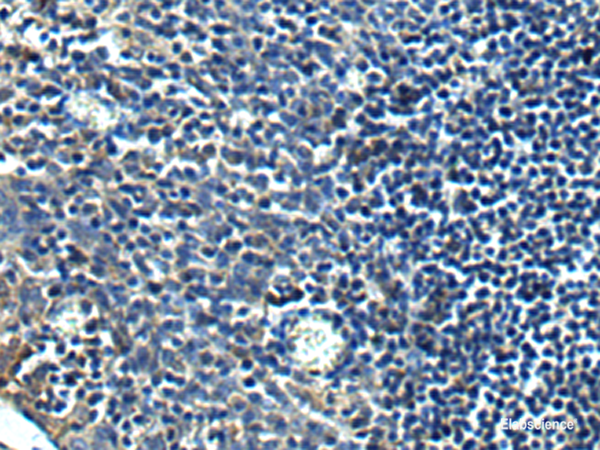 Immunohistochemistry of paraffin-embedded Human tonsil tissue using PRRT2 Polyclonal Antibody at dilution of 1:40(×200)